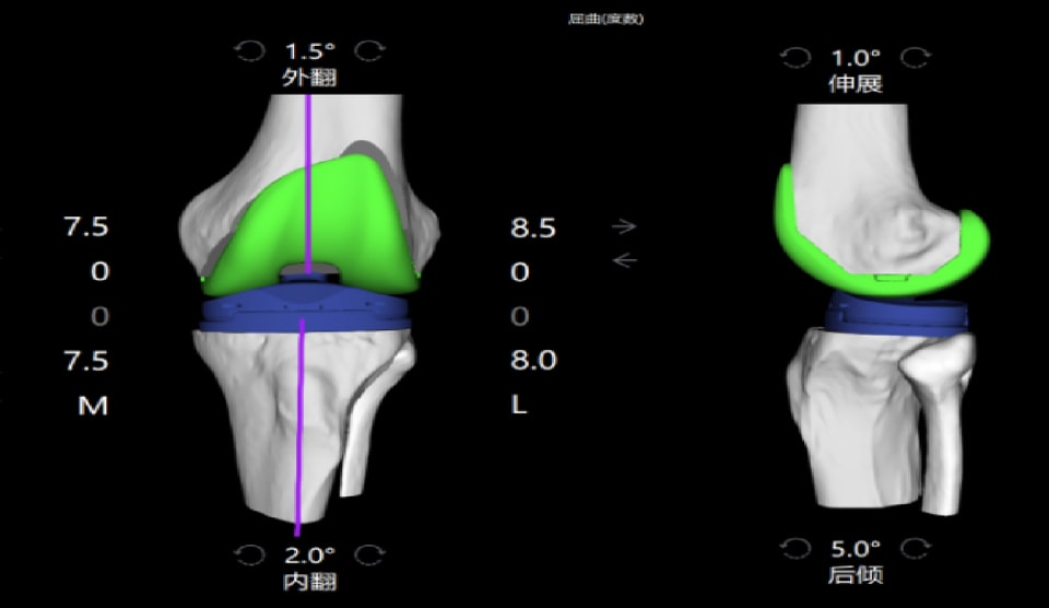 Estrategia de integración sin fisuras